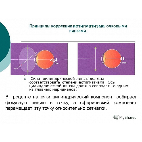 Торическая линза. Решение астигматиков